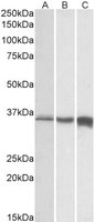 EB12033-B 1