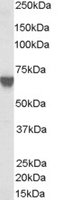 EB06556 1