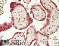 EB05902 2