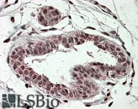 EB08131 1