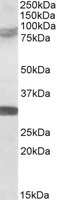 EB05914 1