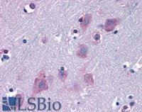 EB05914 2