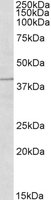 EB05932 1