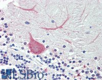EB09901 2