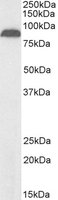 EB08515-B 1