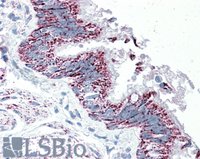 EB09832 1