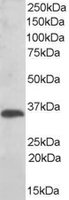 EB05086 1