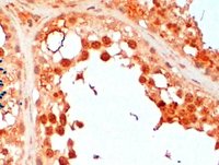 EB05752 1