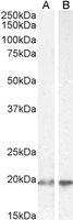 EB05569-T 1