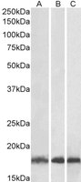 EB05770 3