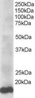 EB05770-T 1