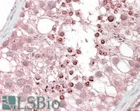 EB08663 1