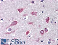 EB08665 1