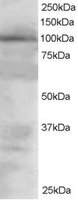 EB05337 1