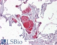 EB05337 2