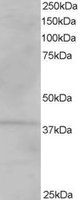 EB06256 1