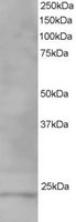 EB06276 1