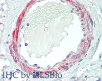 EB06268 3