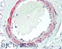 EB06268-T 3