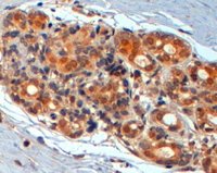 EB07253 2