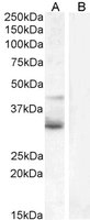 EB05374-T 1