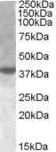 EB08557-T 1