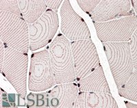 EB06923 2