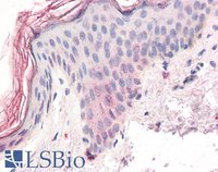 EB05745 2