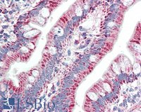 EB11188 2